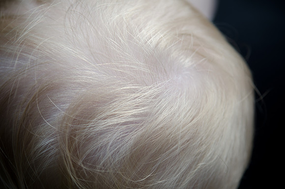 _Harry_B020613-67